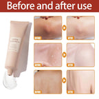 ClearSkin Exfoliating Gel - Radiant Skin in 1 minute